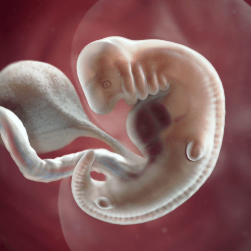 Фото ребенка 8 недель беременности фото