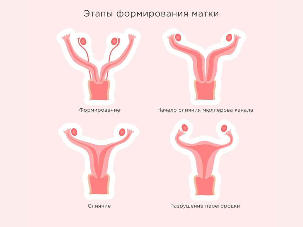 Седловидная матка: преграда к зачатию или нет - Lada Clinic